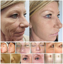 Load image into Gallery viewer, Dr. Pen M8  Rechargeable Micro-Needling Anti-Aging Therapy Pen System
