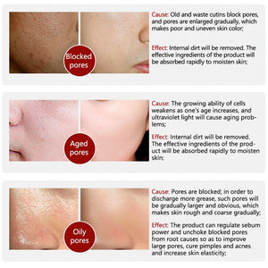 LABENA  Pore Treatment Serum to Shrink Pores Clear Blackheads/Acne